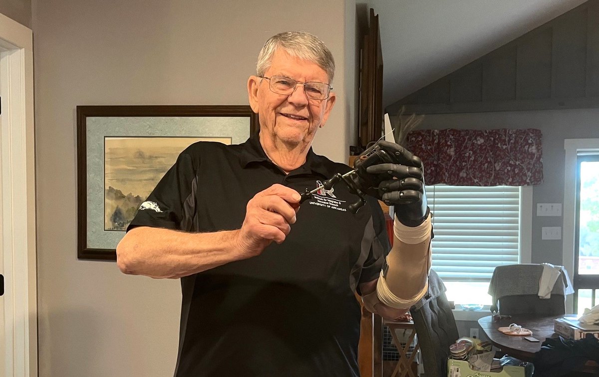 TRI at UAMS (@tri_uams) on Twitter photo Following his historic surgery <a href="/uamshealth/">UAMS Health</a> to receive an experimental prosthetic hand system, Dewey Hickey is amazed at his recovered sense of touch and grip. tinyurl.com/2xpfvsn2
#TRI #CTSAProgram #I3R Following his historic surgery <a href="/uamshealth/">UAMS Health</a> to receive an experimental prosthetic hand system, Dewey Hickey is amazed at his recovered sense of touch and grip. tinyurl.com/2xpfvsn2
#TRI #CTSAProgram #I3R