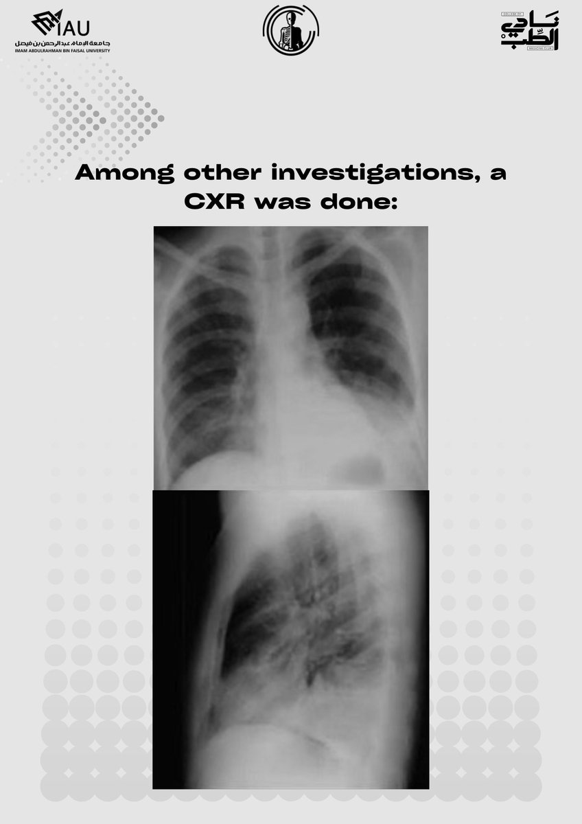 RadClubIAU's tweet photo. Hope everyone had a chance to review the chest anatomy and imaging we posted a few days ago, because this time the challenge is onπ₯, starting with the first case in this theme π©»π§
Answer below ππ»
#RadClubIAU #SeeingTheUnseen #ChestImaging https://t.co/Gmcf0Qjr18