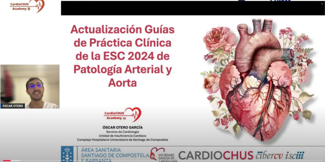 arturaortahub's tweet photo. European Guidelines - Aortic & Peripheral Artery Disease
📌Update webinar #CatedraUSCSemergen
🗣️Manuel Portela Romero
🗣️Oscar García Otero
🗣️Alejandro Rodríguez Río
🗣️Jorge Pablo Ortega
📌Proud of Guidelines Chairperson José Rodriguez Palomares, VIDEO HERE https://t.co/yBuEfXoVmM https://t.co/4J8etBHsC7