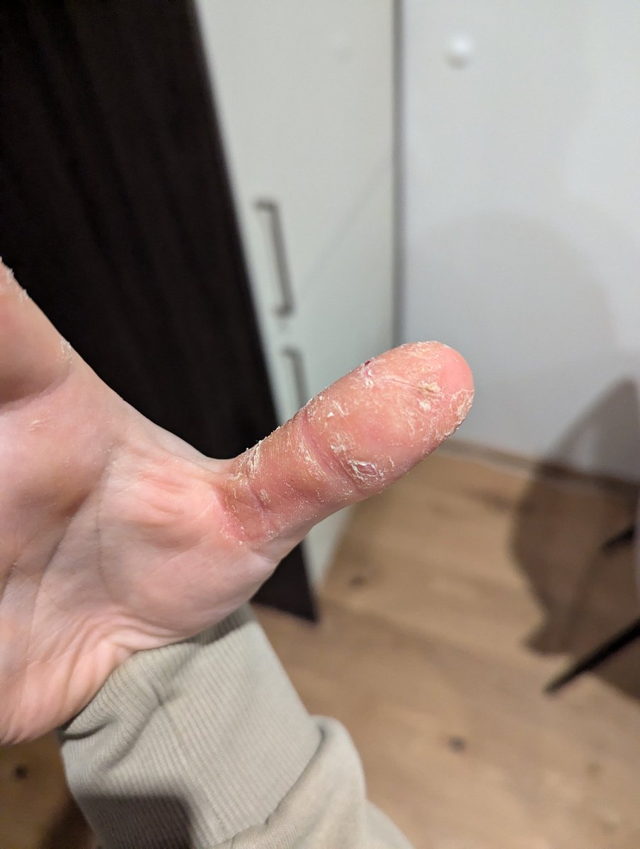 Albert tweet media