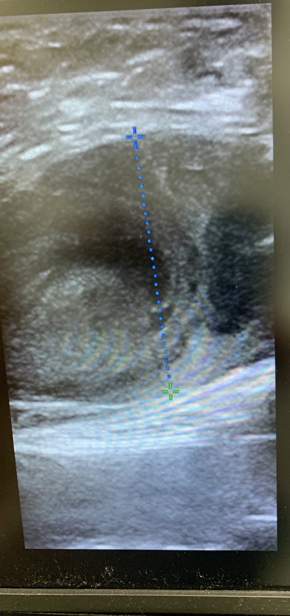 Kuldeep Singh MD tweet media