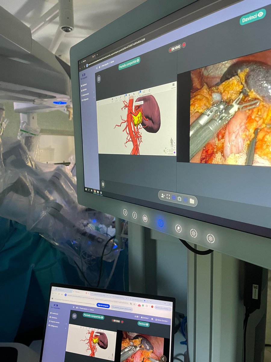 CirugiaSanchi's tweet photo. Today,together with @ZerintiaTech and @CellaMedical3D we explored new communication methods to implement tele-surgery and enhance remote training.
Always committed to providing the highest quality for our patients and advancing the #technology in our #operatingrooms. https://t.co/G3CayGxwRi
