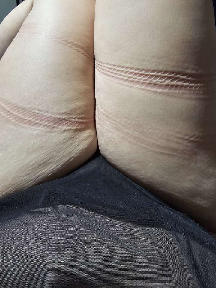 Lizdean1027's tweet photo. I just love the way my skin looks marked up. https://t.co/F3zaVkzEZ4