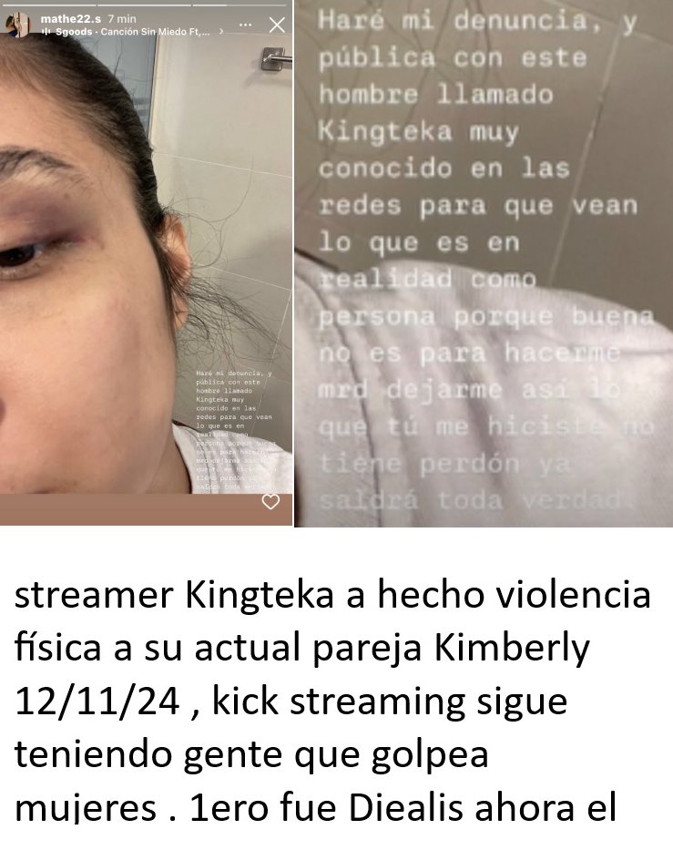 CalderonBa92332's tweet photo. el streamer kingteka de #kickstreaming @KickEspanol @kick a golpeado a su actual pareja por no tener show, kick streaming tiene esta clase de tipos? the streamer kingteka has beaten his partner simply for not respecting their relationship and having others in his life https://t.co/QCFR1sKtPu