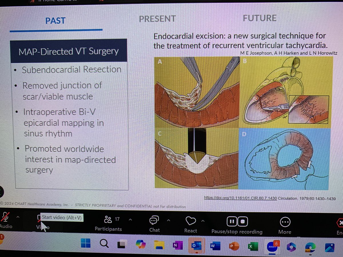 ChartAcademy's tweet image. Great course this evening on VT!
Reentry review! 
Pacing review!
Algorithm reviews!

Join us next month!
#epeeps #vivaep #Vtach