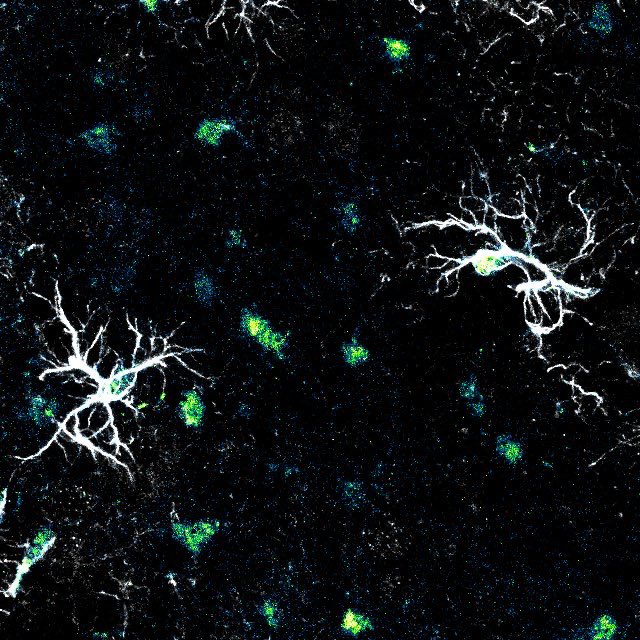 PhDPetite's tweet photo. Beautiful images hot off the microscope from my trainees, @independent_dai and Cathy, showing astrocytes in key sensory brain regions. Can’t wait to see what we find ⭐️ https://t.co/k2xtrLkaOv