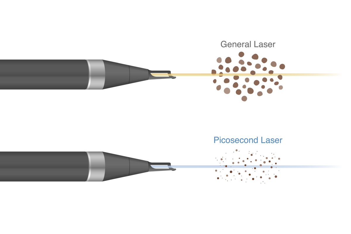 AllThingsVain's tweet photo. Dark spots, sun damage, and age spots don’t stand a chance against our ClearLaze Pico Laser! Experience the power of advanced laser technology for a brighter, even complexion. 

https://t.co/2bz5w0Q6yD

#Hyperpigmentation #ClearLazePico https://t.co/hN05dJEoCQ