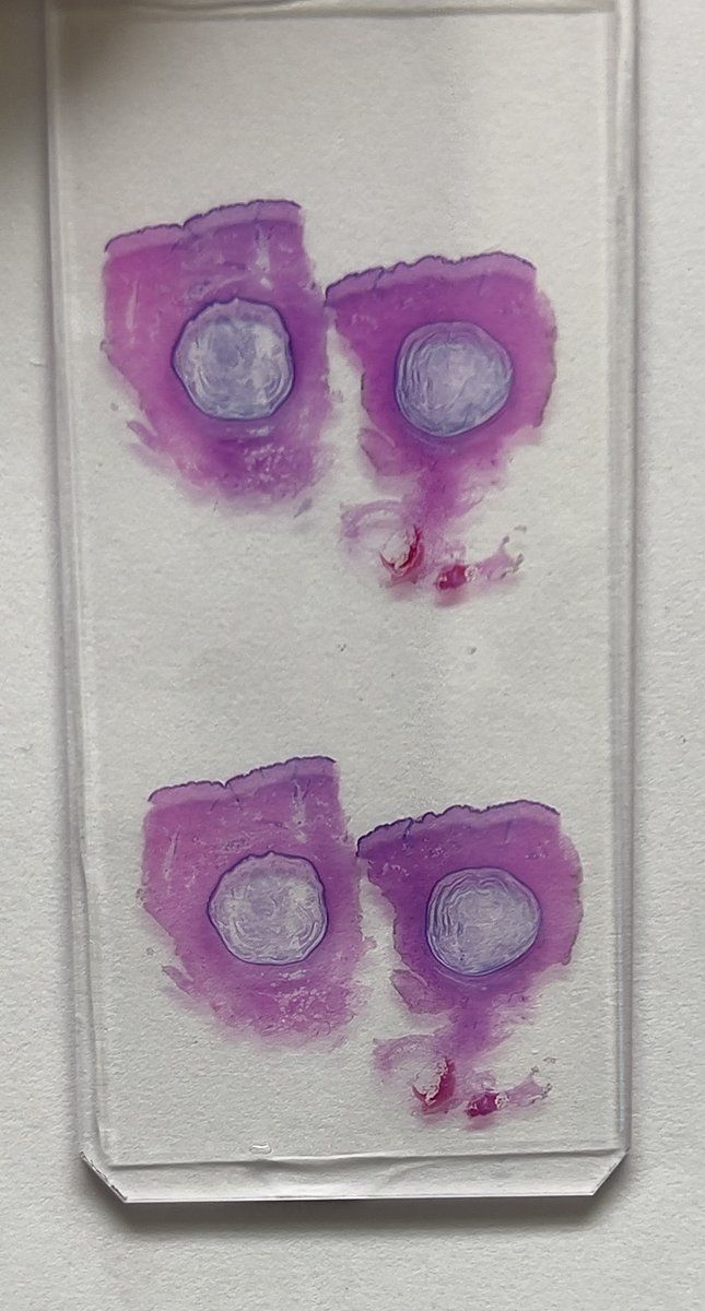 Diagnosable without a microscope: