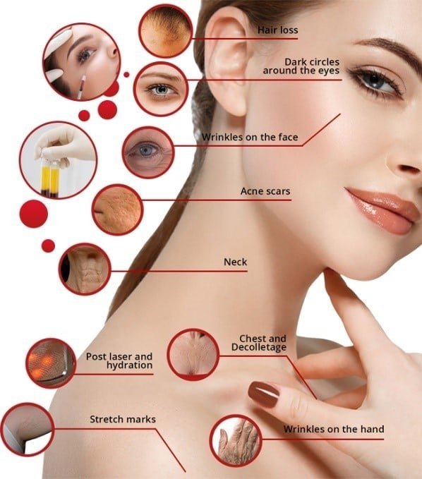 AllThingsVain's tweet photo. Get the best of both worlds with our BOGO PRP + IPL “Combo”! Includes two IPL treatments and two PRP facials for unbeatable results at $1,352.

https://t.co/nNwaJZqbar

#SkinRejuvenation #BlackFridayDeals #denver #lonetreecolorado #parkercolorado #Parker #highlandsranchcolorado https://t.co/SHtXg69ORK