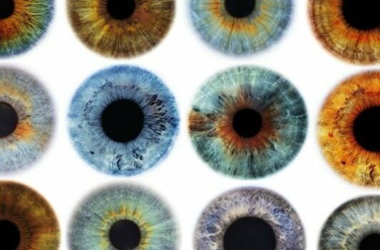 RhodesianAussie's tweet image. #CentralHeterochromia is caused by differing melanin deposits in the eyes.
Is this related to the #pinealgland, crystallized with the fluoride &quot;pink drink&quot; in GATE/TAG class?

Is this why the government chose many for #GATEprogram as children?

gatheringclarity.com/central-hetero…