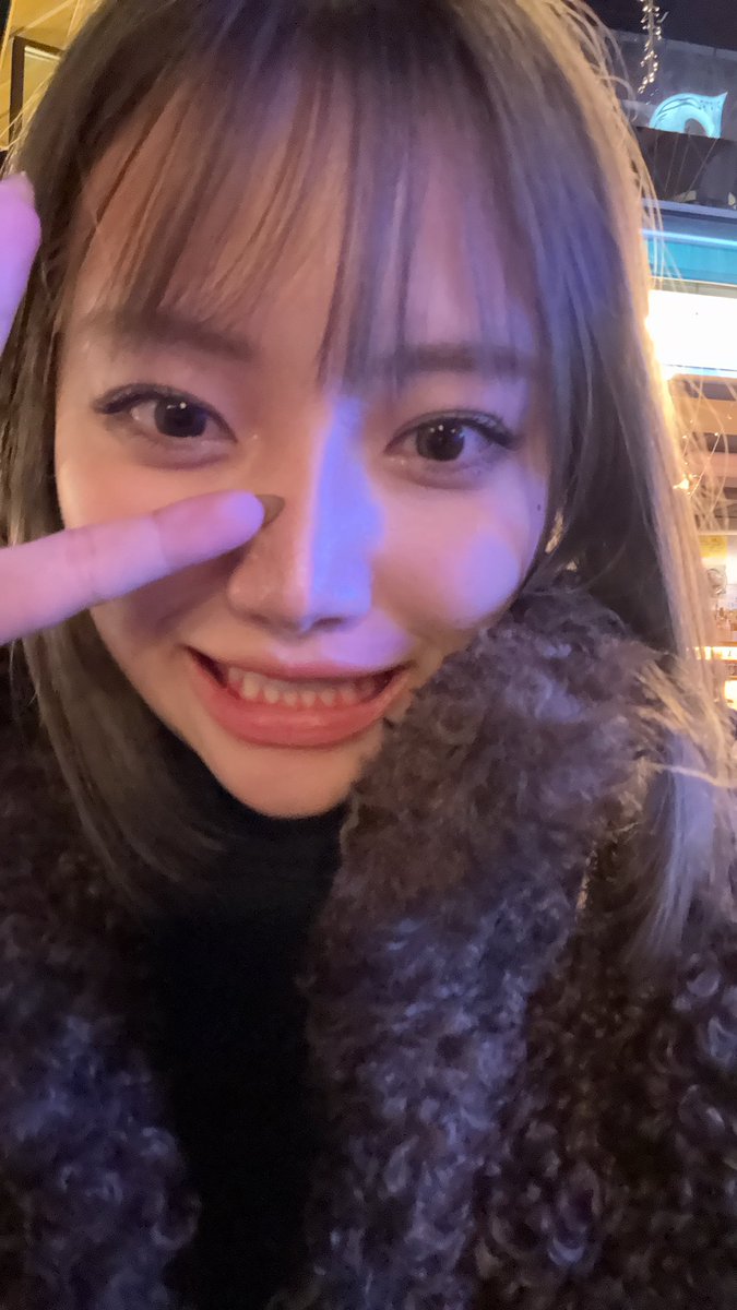 fromrikapanda's tweet photo. 韓国でウルセラ/ボルニューマ/リズネ/ジュベルック一気にやったビフォアフがやばすぎる。すべてiPhone16pro内カメ無加工

←                                                   →
施術前日　　　　　　　施術2日後
施術当日Before              DT

目まで腫れてどう森の蜂に刺された子😇一気施術NG https://t.co/aSe2HMf7oS