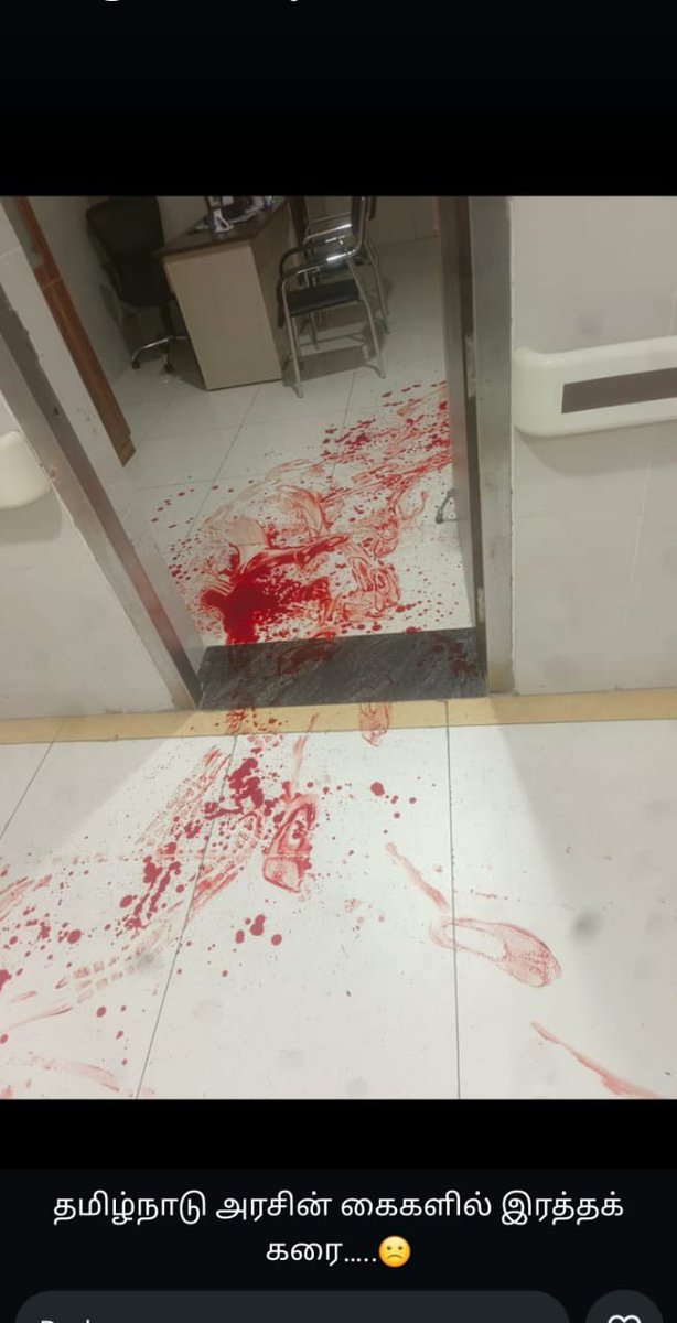 DrRohanKrishna3's tweet photo. Make ur kids choose any profession but not #Doctor in this country.

Safety of Healthcare professionals in India is a joke!!!! 

With only talks of Violence/ Stress/ Mental Health / Low pay scale / cut those competition !!!!!!!!

It’s
 safer to be jobless than to be a doctor. 

*25-year-old stabs doctor at Chennai hospital, four detained* 

The doctor has been admitted to the hospital’s ICU with serious stab wounds.

CHENNAI: A doctor, Balaji Jaganathan, who was in his Oncology department, was stabbed by a man posing as a patient around 10.15am.
The accused, aged around 26, tried to escape from the hospital but was chased and nabbed by the fellow hospital staff and handed over to the Guindy police station. The details of the detained suspect were not revealed by the police.

Chennai (Tamil Nadu): Doctor stabbed in hospital/ Tamil Nadu medical & family welfare minister MA Subramanian reaches hospital/ visuals 

@MoHFW_INDIA @CMTamilnadu @AmitShah @BJP4India @INCIndia @ProfCong