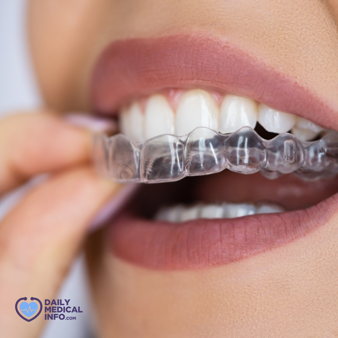 DMedicalinfo's tweet image. يزاد خطر التعرض للسقوط أو لإصابات الوجه، عند ممارسة رياضات معينة، مثل كرة القدم والملاكمة والكرة الطائرة والتزلج، وفي هذه الحالات يساعد ارتداء #واقي_الأسنان على حماية الأسنان، والوقاية من تعرض اللسان والشفاه للإصابة
#MouthGuard #dailymedicalinfo