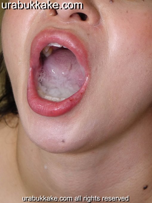 clots
