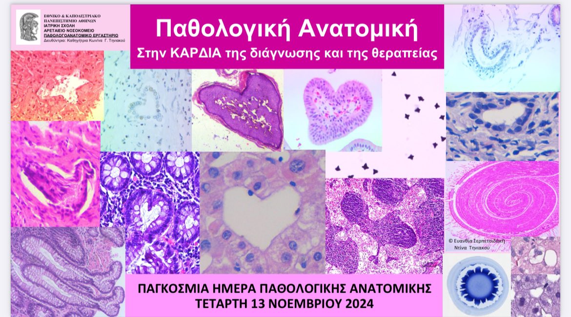 Dina Tiniakos (@dinatiniakos) on Twitter photo Pathology 🧬🔬in the ❤️ of diagnosis and treatment - International Pathology Day 13 November 2024 <a href="/ESP_Pathology/">European Society of Pathology (ESP)</a> <a href="/EASLnews/">EASLnews</a> <a href="/my_ueg/">my_UEG</a> #PathTwitter <a href="/BritishDivIAP/">BDIAP</a> <a href="/histopathology/">histopathology 🔬</a> <a href="/IEspositoPATH/">Irene Esposito</a> Pathology 🧬🔬in the ❤️ of diagnosis and treatment - International Pathology Day 13 November 2024 <a href="/ESP_Pathology/">European Society of Pathology (ESP)</a> <a href="/EASLnews/">EASLnews</a> <a href="/my_ueg/">my_UEG</a> #PathTwitter <a href="/BritishDivIAP/">BDIAP</a> <a href="/histopathology/">histopathology 🔬</a> <a href="/IEspositoPATH/">Irene Esposito</a>
