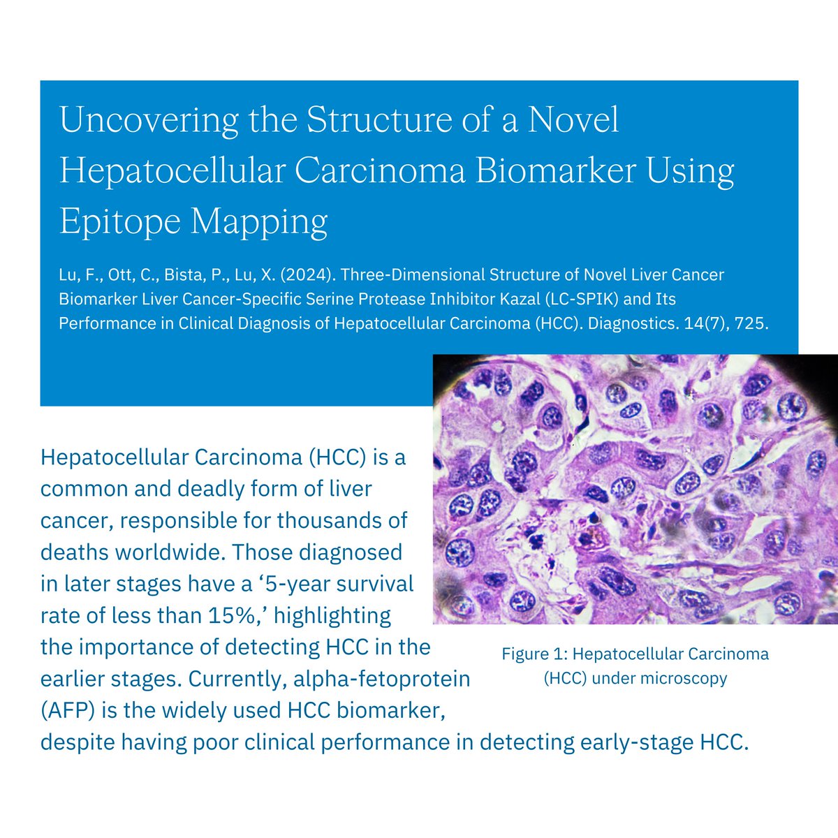 BiosynthGroup's tweet image. Part 2/4 Biosynth&apos;s #epitopemapping helped to uncovered the structure of a novel #HepatocellularCarcinoma (HCC) #biomarker, leading to the development of an #ELISA test kit that selectively and reliably detects HCC. Read the paper t.ly/l-FTB