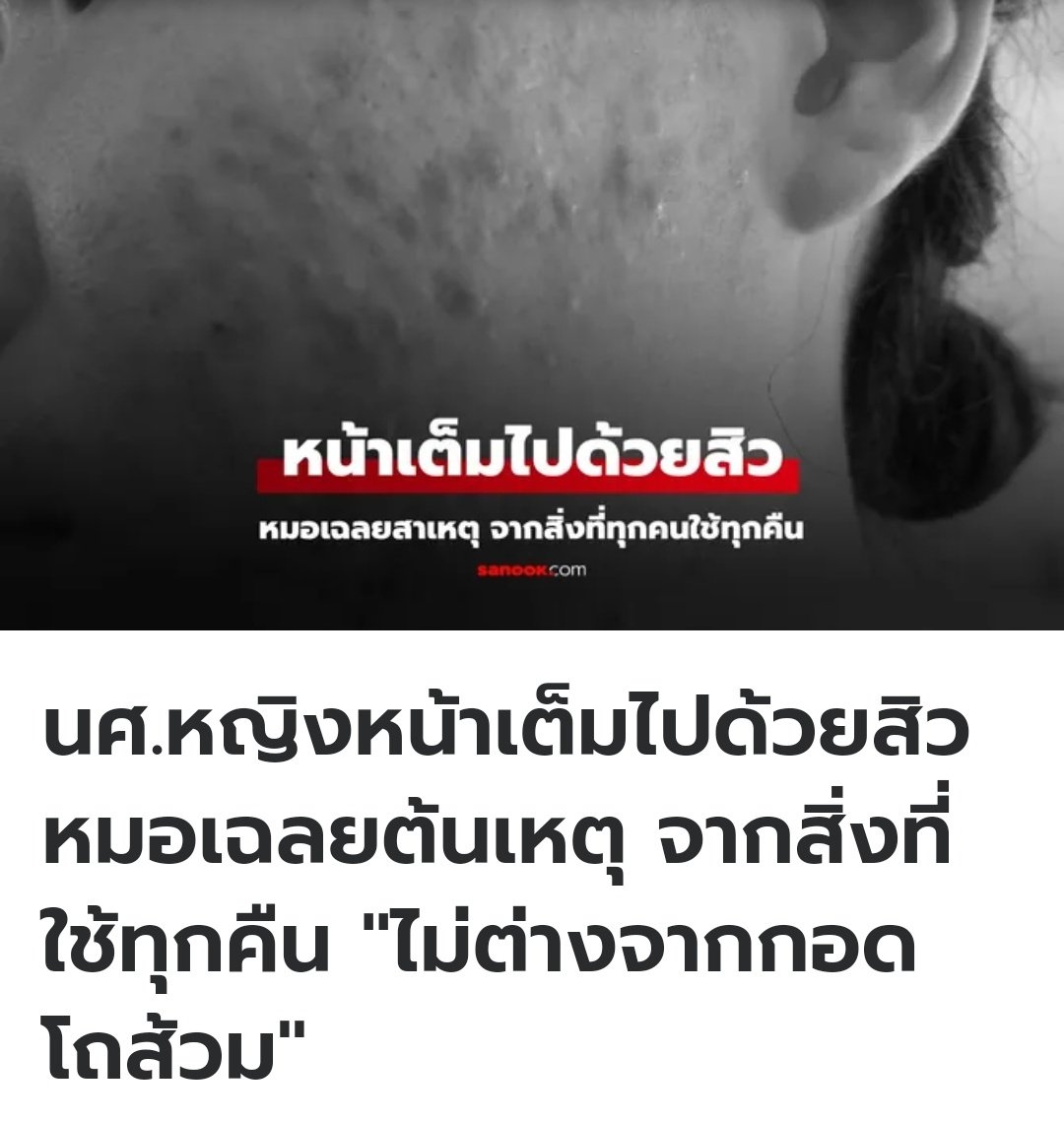 ที่ไต้หวัน นักศึกษาคนนึงมาหาหมอ เพราะมีสิวเต็มหน้า  คุณหมอตรวจสอบแล้วพบว่า ผ้าปูที่นอนของน้อง ไม่เคยซักมานาน 1 ปี ทำให้เชื้อโรคสะสม สกปรกมากกว่ากอดชักโครกนอนอีกครับ