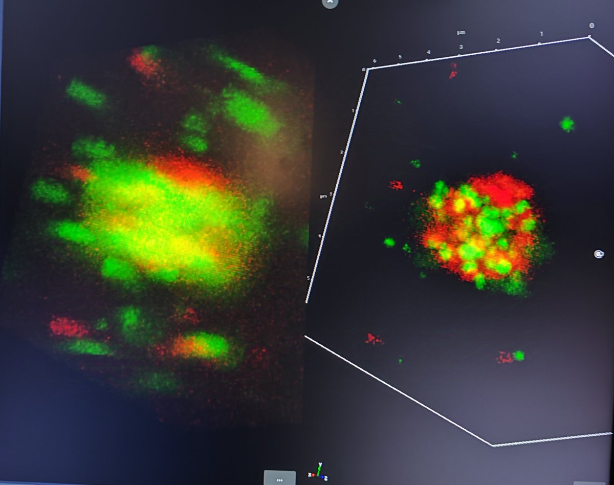 FEghiaian's tweet photo. Insane imaging at our @Abberior on-site workshop today ! Confocal is a blur in z, but with 3D #STED, you can now count, measure, and appreciate the morphology of molecular clusters like never before, see whether #colocalization is fake or real... with Abberior #FACILITY only ! https://t.co/8BJf7a7qPp