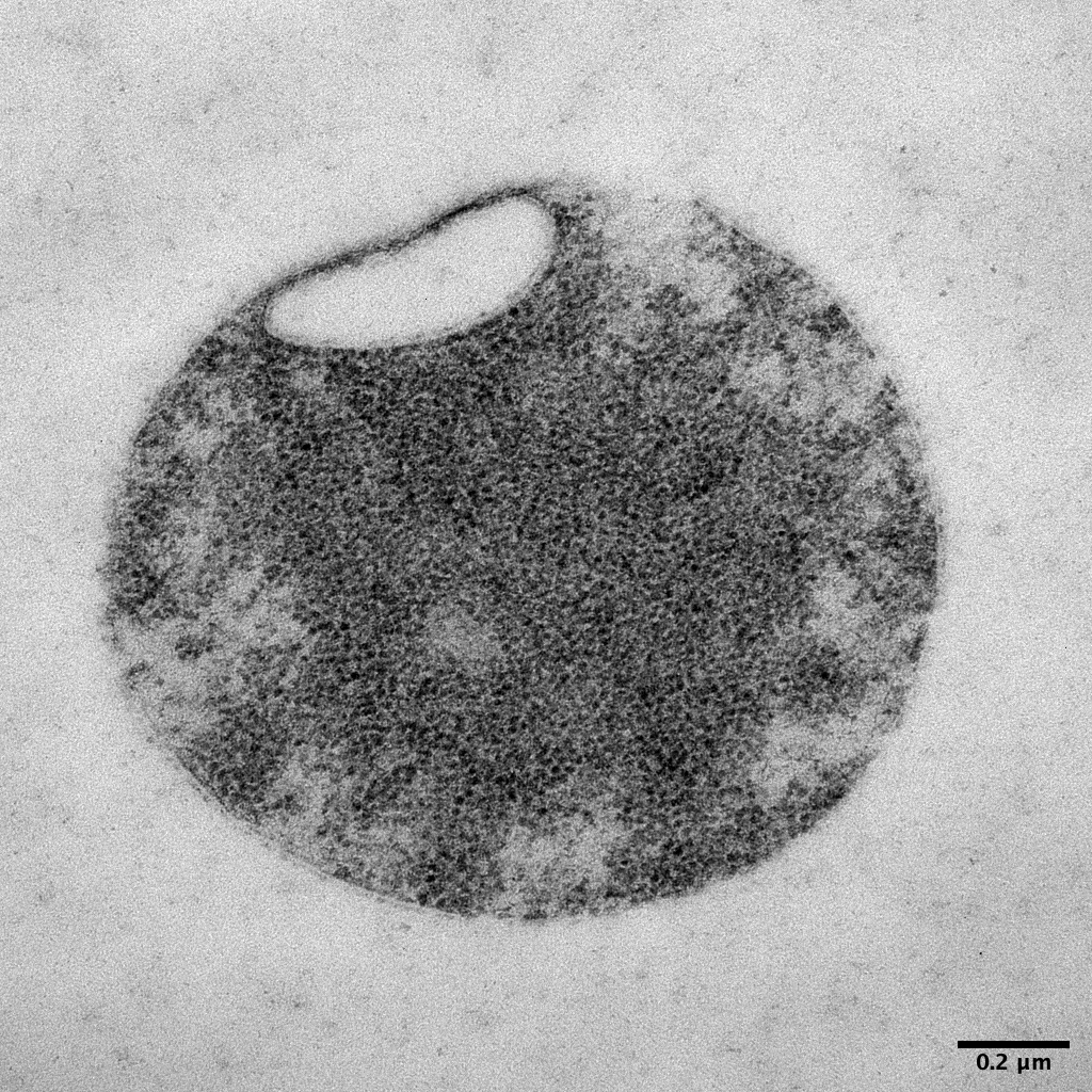 Sáenz Lab (@labsaenz) on Twitter photo 🥳A tuneable minimal cell membrane reveals that two lipid species suffice for life: nature.com/articles/s4146…. We chemically minimized the membrane of the Minimal Cell...they survived, but with some interesting shapes, like this 'Death Star' phenotype <a href="/Ijustice555/">Isaac</a> <a href="/JCVenterInst/">J. Craig Venter Institute</a> 🥳A tuneable minimal cell membrane reveals that two lipid species suffice for life: nature.com/articles/s4146…. We chemically minimized the membrane of the Minimal Cell...they survived, but with some interesting shapes, like this 'Death Star' phenotype <a href="/Ijustice555/">Isaac</a> <a href="/JCVenterInst/">J. Craig Venter Institute</a>