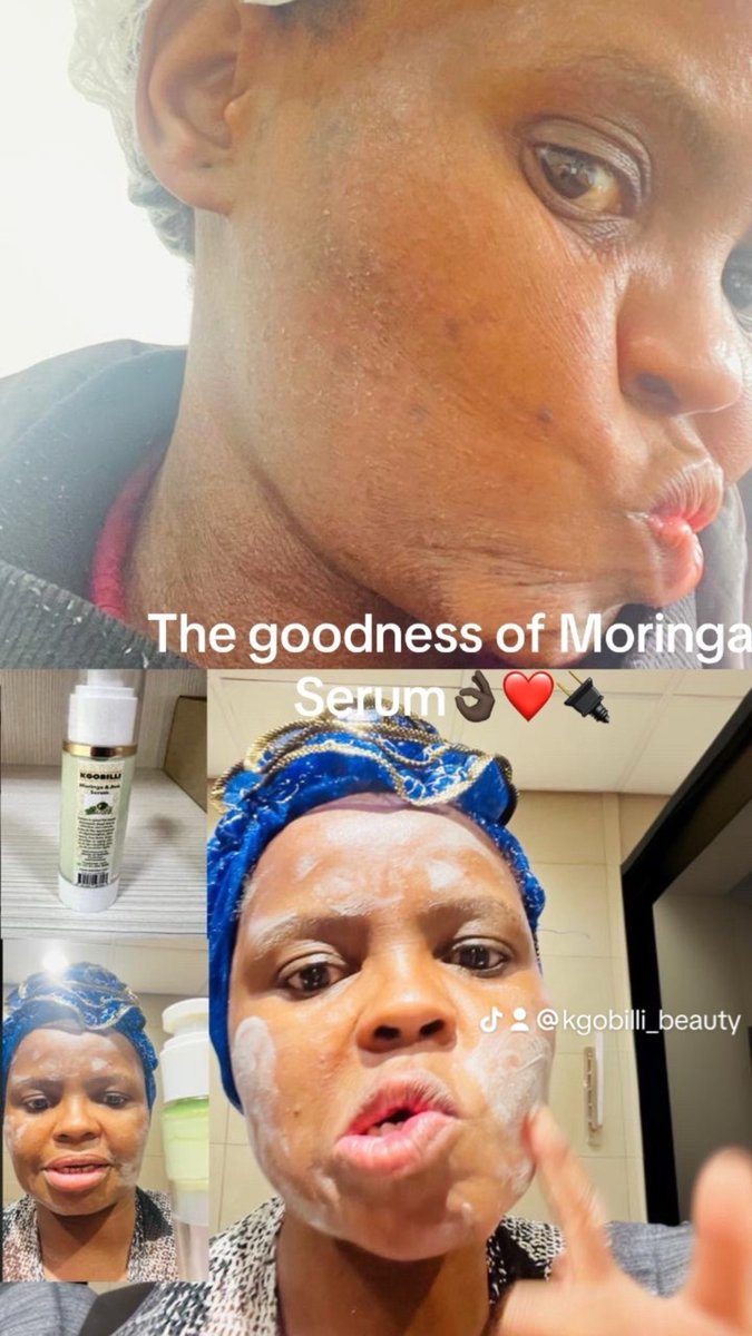 kgobillion's tweet photo. Celebrating 3 years of healing through Kgobilli_ Beauty Skin Care👌🏿 https://t.co/DuY8i1fG2K