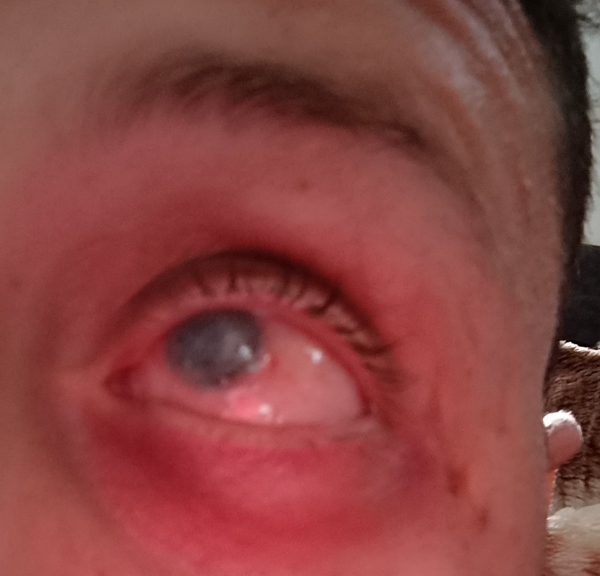 ahmedshameya995's tweet image. Pain Again, I Swear The Pain Is Intolerable.
Please pray for me.👇🏻
gofund.me/e72769fc