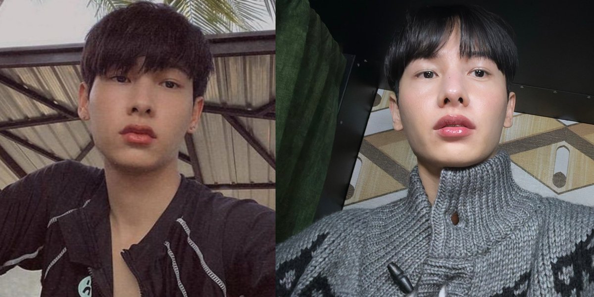 decedalueeee's tweet photo. Then                                    Now https://t.co/iNaUL3RYKl