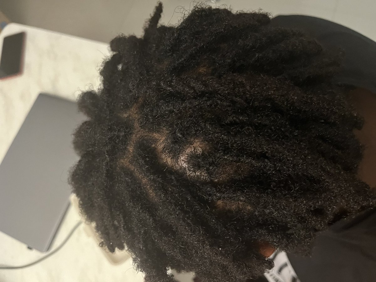 fred_tch's tweet image. 8 months hair growth #Rasta #Dreadlock #Freedom #EntrepreneurMindset #BornToFly #
