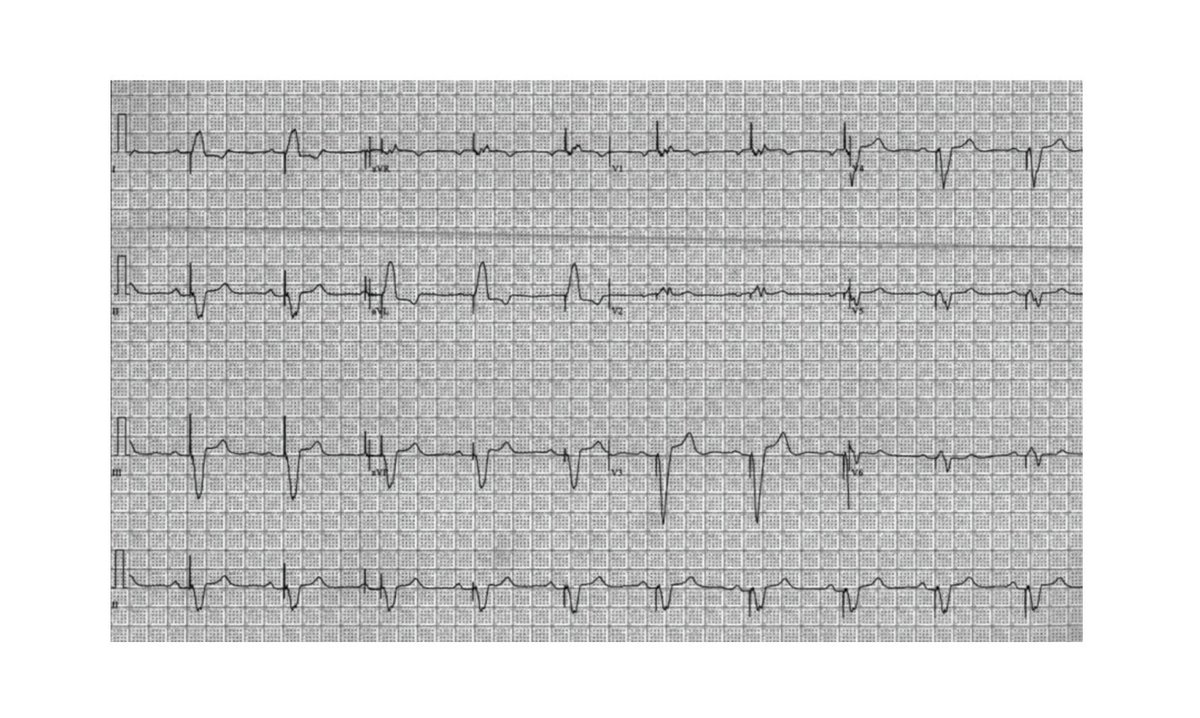 EP Lab Digest tweet media