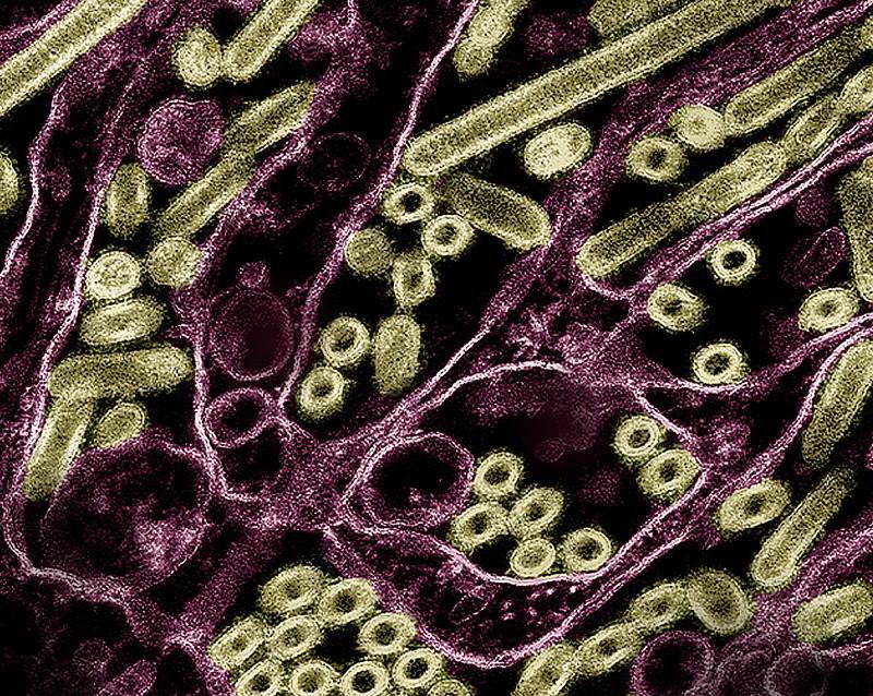 ⚠️BREAKING—ICU Hospitalized human bird flu case in Canada now officially confirmed as H5N1. Worse, it is the same 2.3.4.4b virus clade (variant group) as the one found in BC🇨🇦 poultry and in Washington state🇺🇸! The hospitalized teenager (with no pre existing conditions) had no