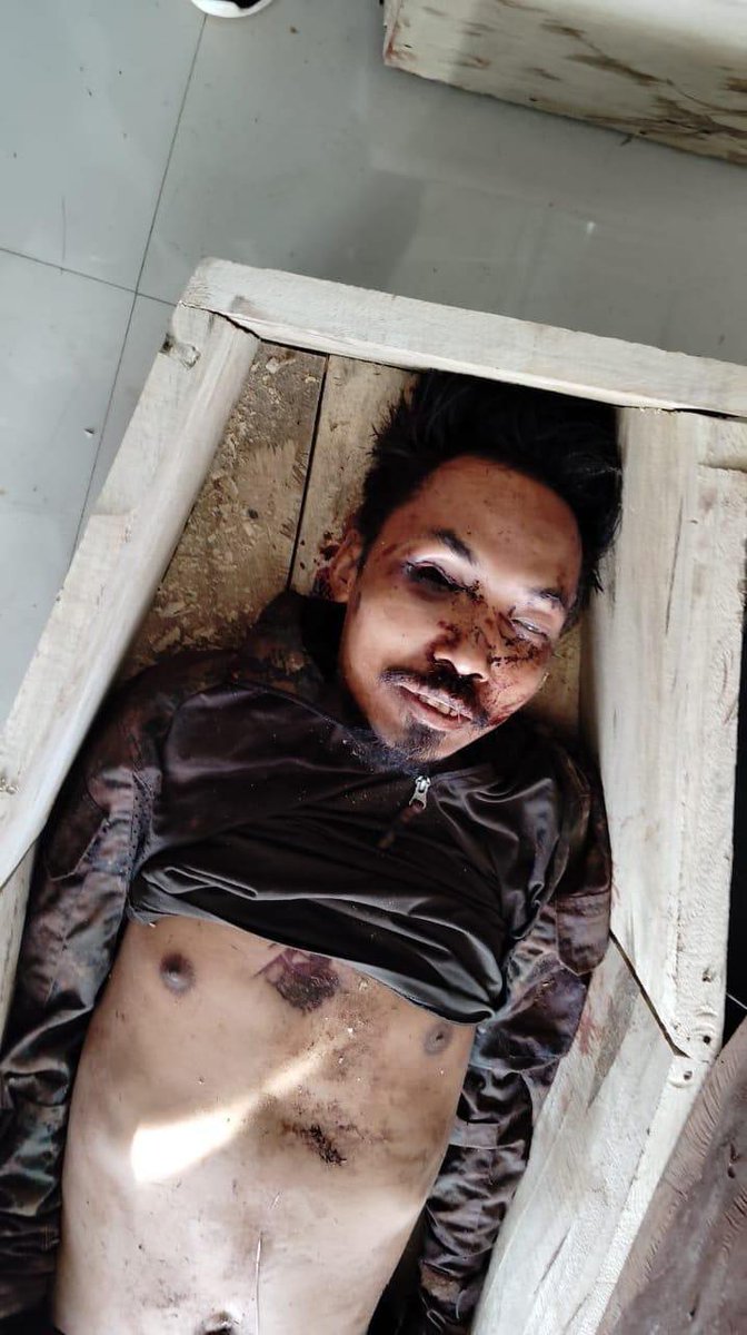 DrLamtinthangHk's tweet photo. The eyes of some among the 11 #Hmar village volunteers were even gouged out. This is solely Human Rights Violations.

Is @crpfindia acted under duress or deliberately?  

@rashtrapatibhvn @UNHumanRights @UN @unhrcpr @UNHRCINV @AIIndia @hrw
@CommissionerH #ShameOnCRPF 
#ManipurViolence