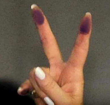 ErradiCasta's tweet photo. #delincuente #cristina #LadronaDeLaNacionArgentina #innombrable #cfk #chorra #cristinaalinfierno #peronismo #pianito https://t.co/rp9pZ8hSwJ
