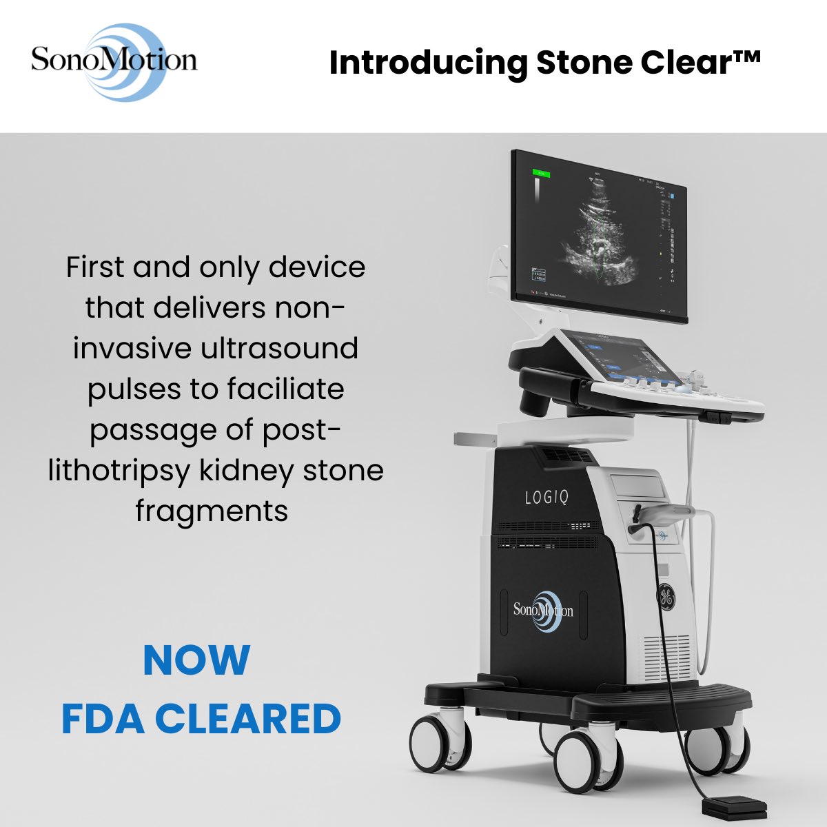Mathew Sorensen (@sorensenmathew) on Twitter photo Thrilled to share - after 10y commercialization plus 6y research prior, <a href="/sonomotion1/">Sonomotion</a> has received FDA clearance for Ultrasonic Propulsion to non-invasively clear residual stone fragments, reducing relapse up to 70%. Thank you <a href="/uwurology/">UW Urology</a> <a href="/NASA/">NASA</a> <a href="/NIDDKgov/">NIDDK</a> and UW Applied Physics lab Thrilled to share - after 10y commercialization plus 6y research prior, <a href="/sonomotion1/">Sonomotion</a> has received FDA clearance for Ultrasonic Propulsion to non-invasively clear residual stone fragments, reducing relapse up to 70%. Thank you <a href="/uwurology/">UW Urology</a> <a href="/NASA/">NASA</a> <a href="/NIDDKgov/">NIDDK</a> and UW Applied Physics lab