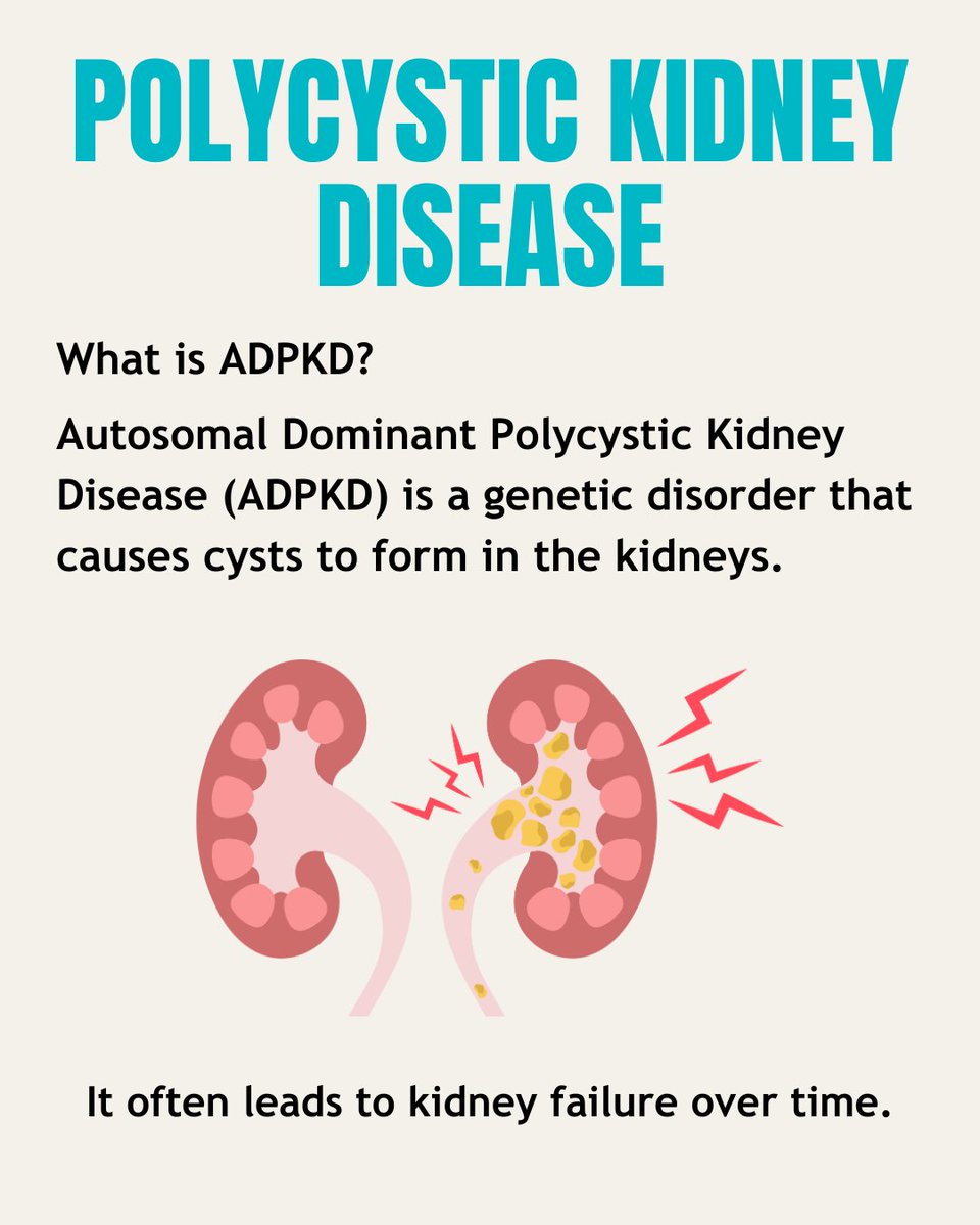 Encore_Research's tweet photo. Understanding ADPKD better can lead to improved treatments and outcomes for those affected. If you or a loved one has ADPKD, consider joining a study to help advance research. 💡 #ADPKD #KidneyHealth #Genetics
https://t.co/U7meMll6Wl https://t.co/PVSjyenQBp