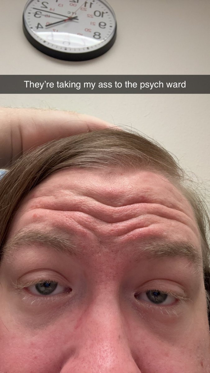 My Nurse asked me why my lips were green and I told her “because I was drinking grandma’s ashes” and now she’s telling me they want to take me to the psych ward <a href="/McNasty/">McNasty</a> <a href="/The_Dooo/">Dooo</a> <a href="/ItsBlarg/">Matt</a> <a href="/Sniping_Soup/">Soup</a>