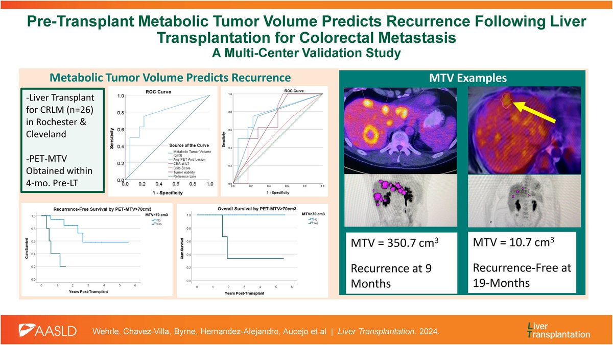 Pre-transplant metabolic tumor volume predicts recurrence following liver transplantation for colorectal metastasis: A multicenter study