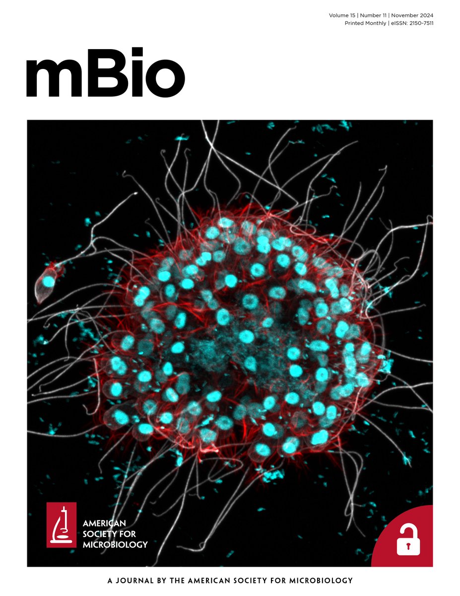 Pawel Burkhardt (@pawel_burkhardt) on Twitter photo The choanoflagellate Barroeca monosierra on the cover of <a href="/mbiojournal/">mBio</a> 🤩. Our work shows that this large colonial choano from Mono Lake harbors live bacteria. Beautiful picture by <a href="/Kayley_Hake/">Kayley Hake</a> #choanoflagellates <a href="/MSarsCentre/">Michael Sars Centre</a> <a href="/UiB/">Universitetet i Bergen</a> <a href="/thembauk/">MBA - Marine Biological Association</a> <a href="/UCBerkeley/">UC Berkeley</a> journals.asm.org/doi/10.1128/mb… The choanoflagellate Barroeca monosierra on the cover of <a href="/mbiojournal/">mBio</a> 🤩. Our work shows that this large colonial choano from Mono Lake harbors live bacteria. Beautiful picture by <a href="/Kayley_Hake/">Kayley Hake</a> #choanoflagellates <a href="/MSarsCentre/">Michael Sars Centre</a> <a href="/UiB/">Universitetet i Bergen</a> <a href="/thembauk/">MBA - Marine Biological Association</a> <a href="/UCBerkeley/">UC Berkeley</a> journals.asm.org/doi/10.1128/mb…