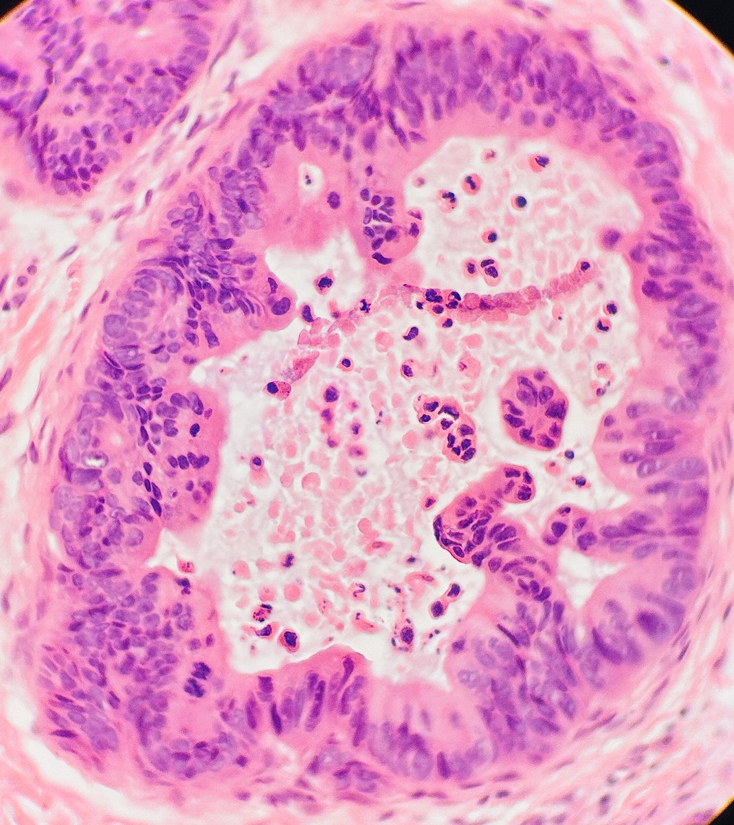 Jay "Thymocyte" Hwang tweet media