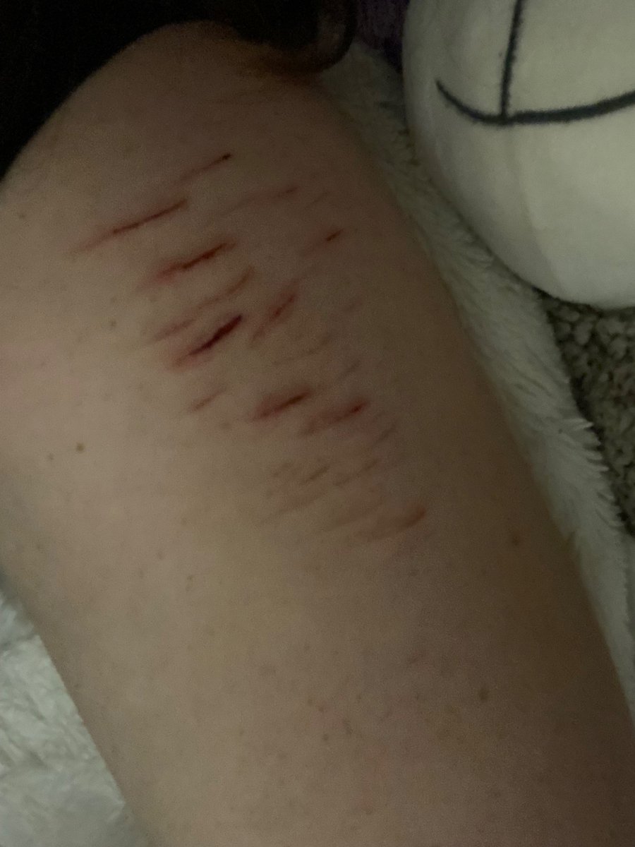 WeirdcoreEnthu1's tweet photo. fresh vs healed ( 8-10 hrs l8r )

ok baaiiiii https://t.co/9vZ2Y0IJRu
