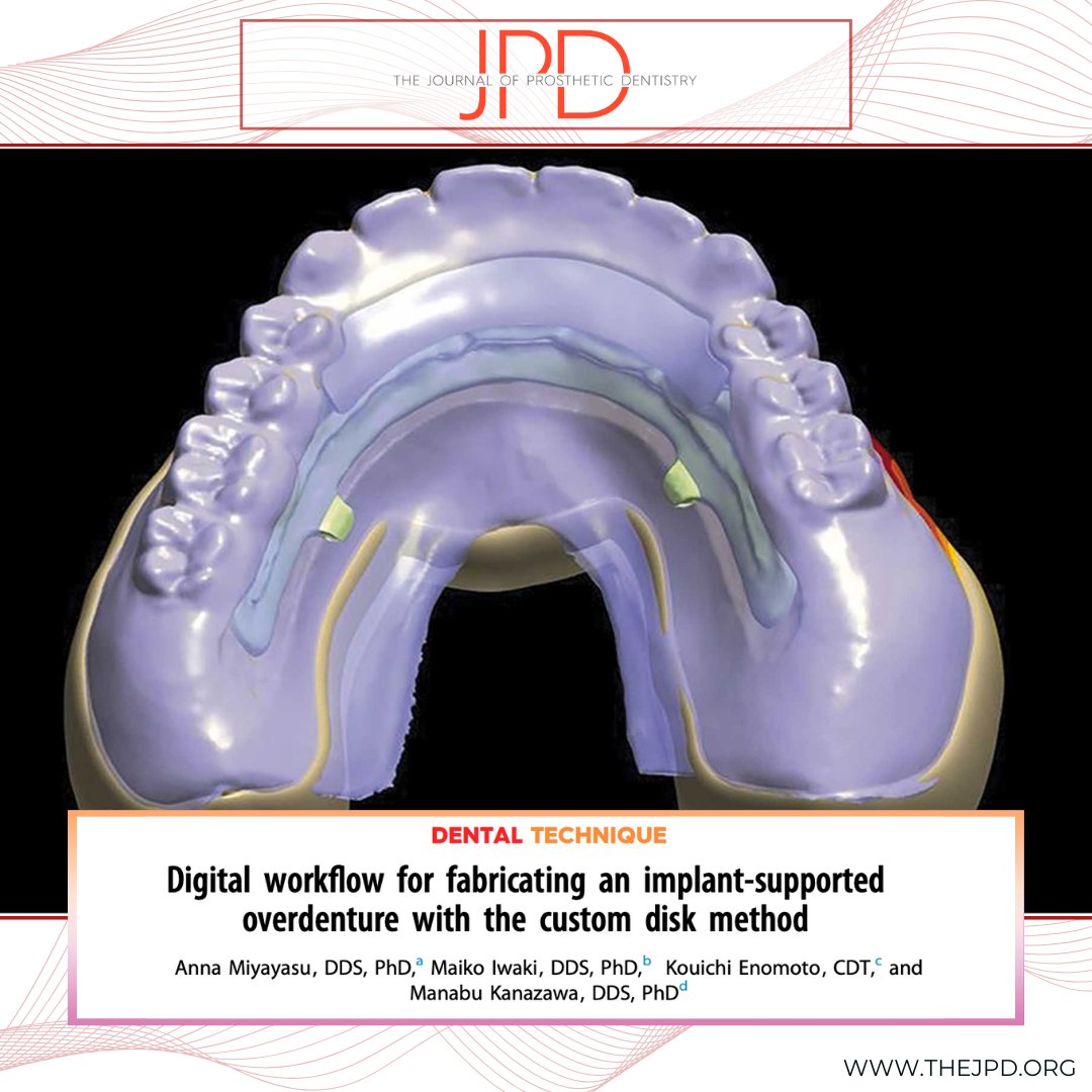 JPDentistry's tweet image. This #dentaltechnique from the #latestontheJPD shows a step-by-step process for incorporating a casted #metalframework within a #dentalimplant retained #denture milled from a customized PMMA disk: thejpd.org/article/S0022-…
