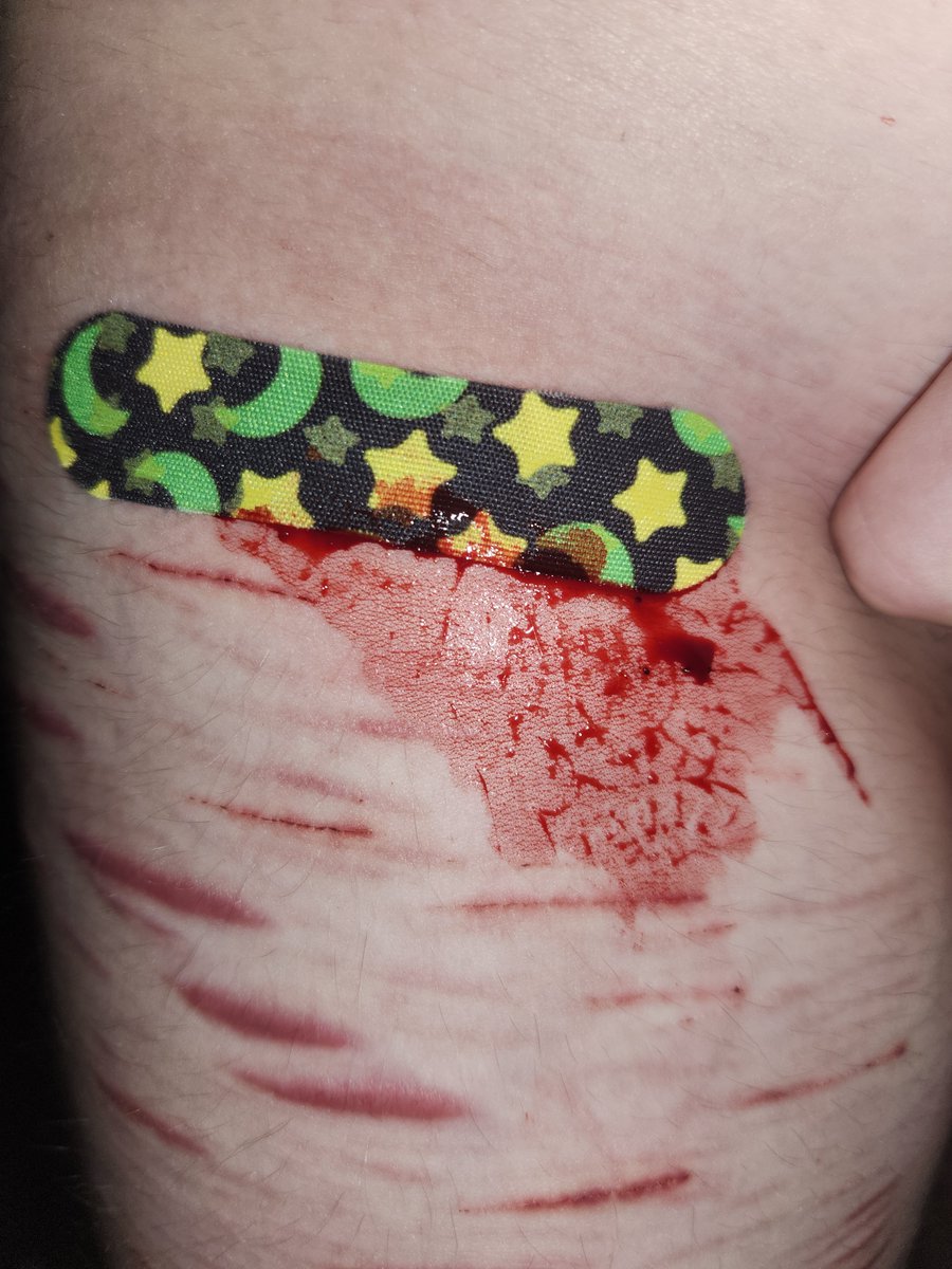 pringless_cann's tweet photo. ITS BEEN SO LONG WHY IS IT STILL BLEEDING. https://t.co/RDhiI7Okac