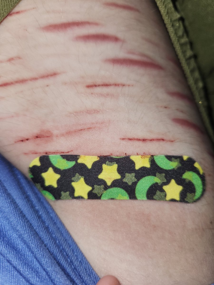 pringless_cann's tweet photo. YALL THOUGH I WOULD FORGET MY GLOW IN THE DARK BANDAID 😁 https://t.co/NiCqBvp7v9