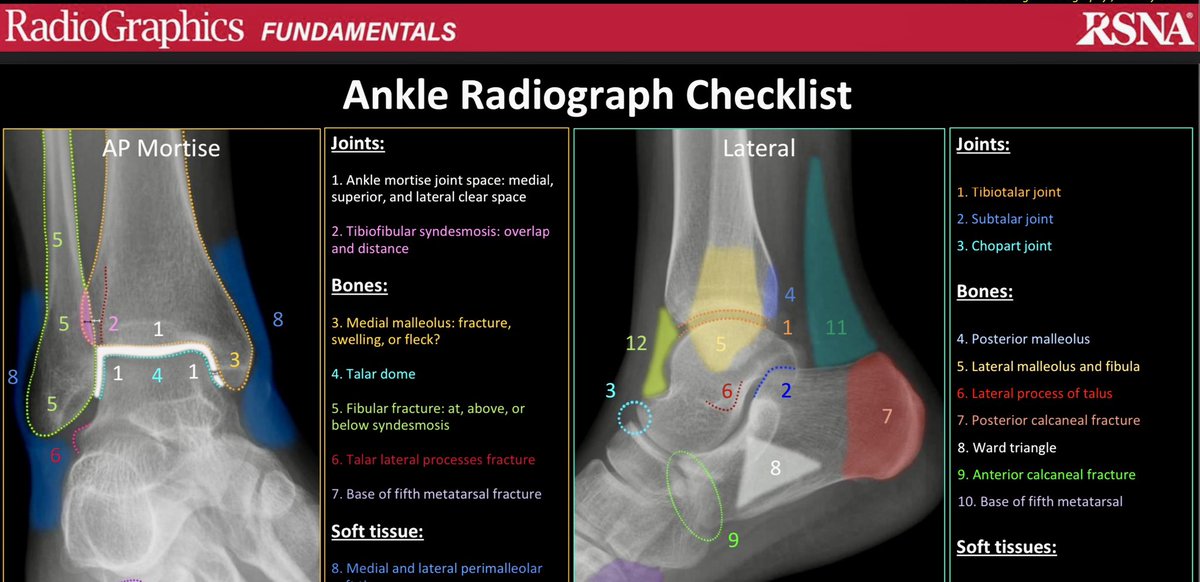Don’t forget the base of the 5th Metatsrsal on the lateral ankle radiograph. 

Ankle radiograph checklist 

—on-call tips