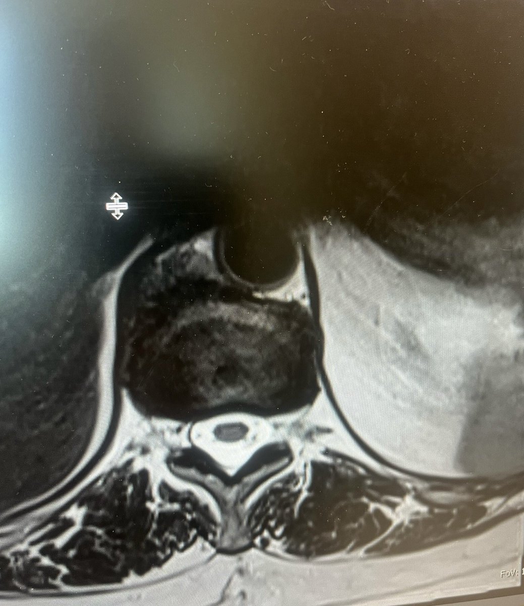 Max H. Epstein, MD tweet media