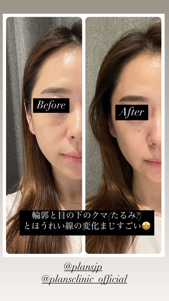 プランエスクリニック - Search / X