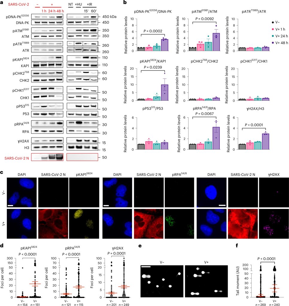 Vipin M. Vashishtha tweet media