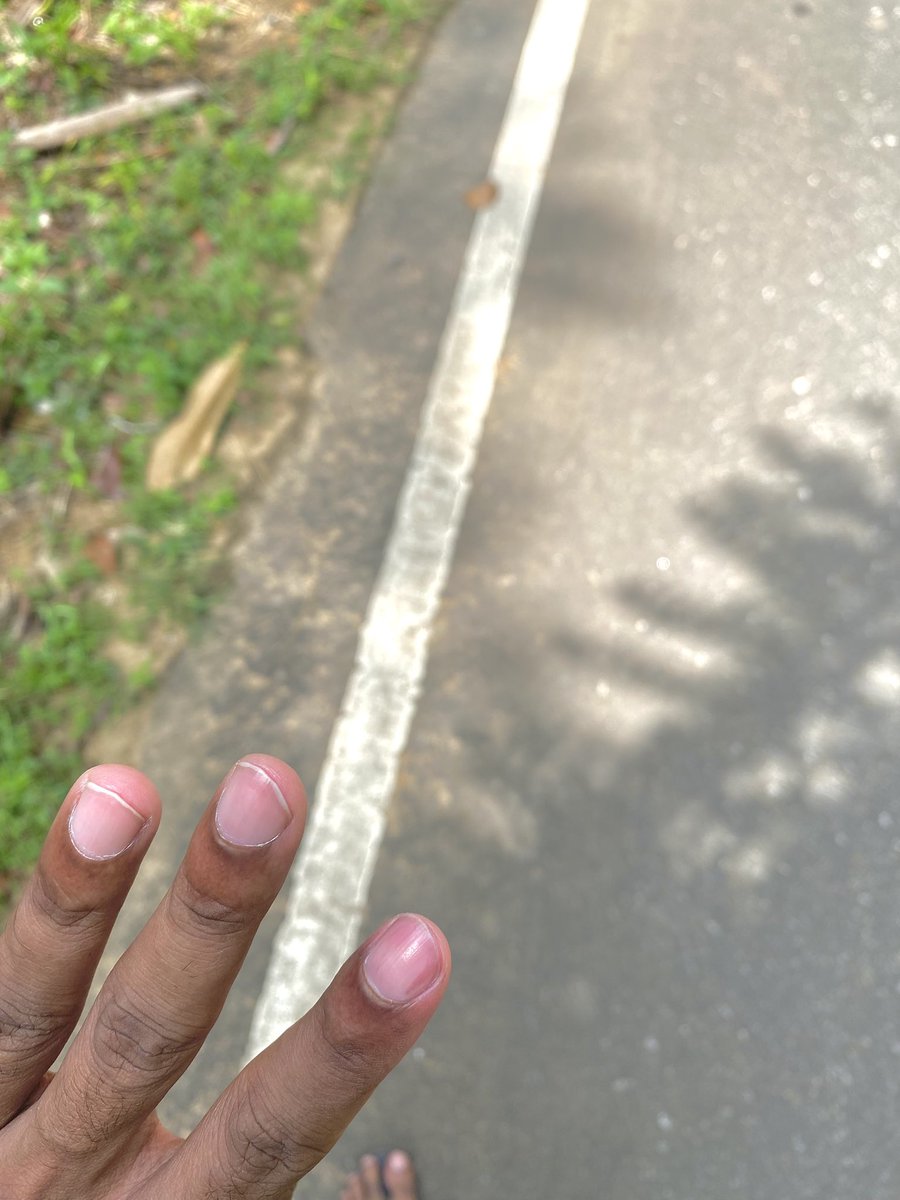 ඌගේ අප්පගේ පාට කිරිල්ලක් ඒක. දාන්නත් කලින් ගිහින් ඉවරයි 🙆🏻‍♂️