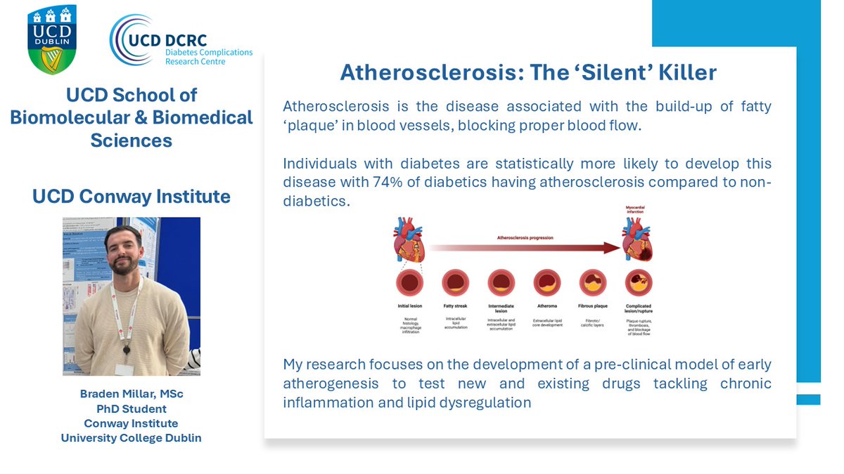 UCD Diabetes Complications Research Centre (@ucddcrc) on Twitter photo On #WorldDiabetesDay Mr Braden Millar <a href="/braden_millar/">Braden Millar</a>, a PhD candidate with <a href="/UCDDCRC/">UCD Diabetes Complications Research Centre</a> & <a href="/moni_dega/">Monica de Gaetano</a> tells us about his research on atherosclerosis.
<a href="/UCD_SBBS/">UCD SBBS</a> <a href="/UCDMedicine/">UCD Medicine</a> On #WorldDiabetesDay Mr Braden Millar <a href="/braden_millar/">Braden Millar</a>, a PhD candidate with <a href="/UCDDCRC/">UCD Diabetes Complications Research Centre</a> & <a href="/moni_dega/">Monica de Gaetano</a> tells us about his research on atherosclerosis.
<a href="/UCD_SBBS/">UCD SBBS</a> <a href="/UCDMedicine/">UCD Medicine</a>