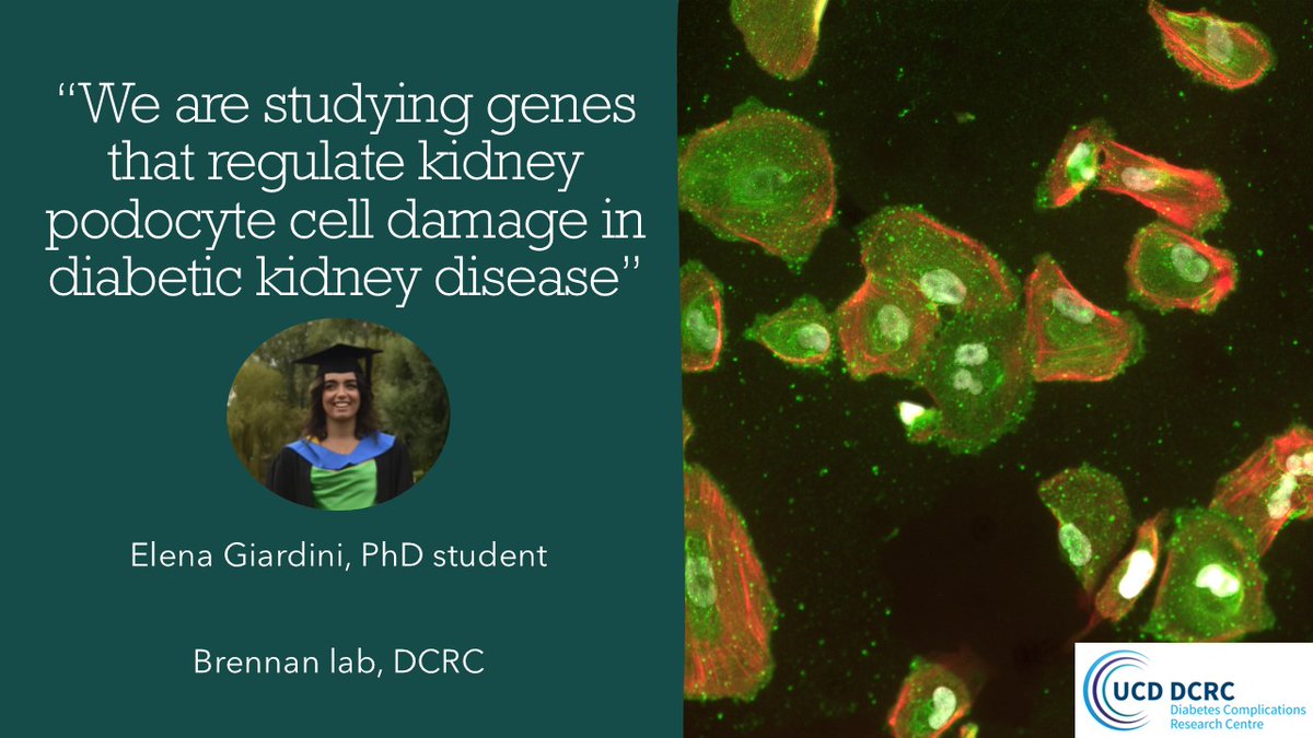 UCD Diabetes Complications Research Centre (@ucddcrc) on Twitter photo #WorldDiabetesDay Ms Elena Giardini, a PhD candidate with <a href="/UCDDCRC/">UCD Diabetes Complications Research Centre</a> & Dr Eoin Brennan, is researching diabetic kidney disease.
<a href="/UCDMedicine/">UCD Medicine</a> #WorldDiabetesDay Ms Elena Giardini, a PhD candidate with <a href="/UCDDCRC/">UCD Diabetes Complications Research Centre</a> & Dr Eoin Brennan, is researching diabetic kidney disease.
<a href="/UCDMedicine/">UCD Medicine</a>