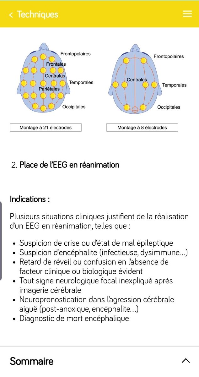🤩🤩🤩 Du nouveau sur l'application e-ICU! Des fiches didactiques réalisées par de jeunes médecins pédagogues! 👨‍🏫👩‍🎓
Mises à jour de la définition de l'insuffisance rénale aiguë, EEG, SHU typique et bien d'autres!...