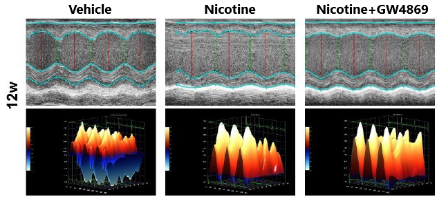 New research from the lab of Yajin Wang highlights the hidden risks of vaping on heart health. This study reveals the crucial role of EVs-ERK5 in lung-to-heart damage, underscoring vaping’s potential cardiac toxicity. 

hubs.ly/Q02X9Db-0.